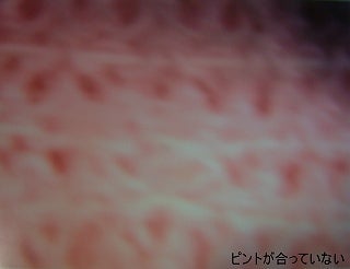 ピントの合っていない顕微鏡写真