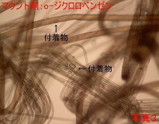 試薬でマウントした顕微鏡写真