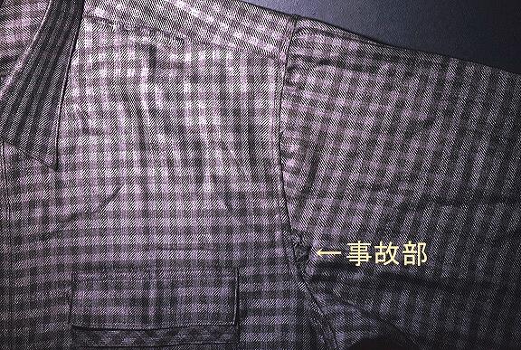 縫い目の滑脱が生じている分を示す写真