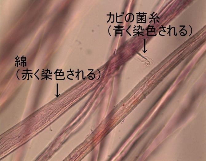 2種類の試薬で染色した繊維の顕微鏡写真