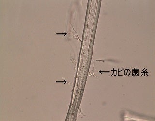 カビの菌糸を示す顕微鏡写真
