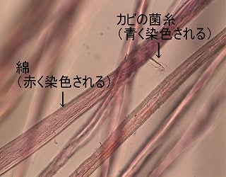 2種類の試薬で染色した繊維の顕微鏡写真