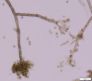 ある製品から分離したクラドスポリウムの顕微鏡拡大像