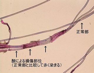 酸による損傷部と正常部を示す顕微鏡写真
